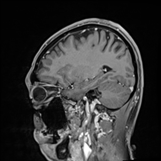 Click on the Serie image to view the images of VILLANUEVA, WILLIAM A.